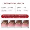 German Toenail Plus Anti-Paronychia Relief Oil for Ingrown and Damaged Nails view 3