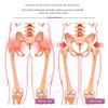 Pelvic Repair Device – Pelvic Massager and Hip Trainer for Uterine Contraction and Bone Repair view 3