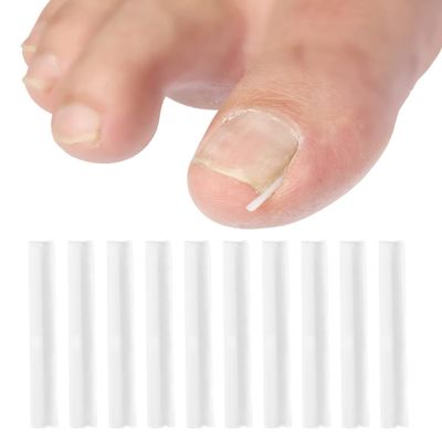 10 Correction Strips for Ingrown Toenails