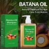Batana Oil Hair Growth Shampoo for Thinning Hair, 300 ml view 2
