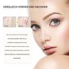 UV Sun Protection Stickers, Wearable SPF Sensor Patches for the Face view 4