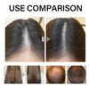 Deoxyribose Sugar Gel for Hair Growth and Hair Loss Care view 3