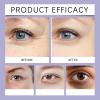 Retinol Eye Cream for Dark Circles and Wrinkles, Moisturizing Under-Eye Treatment to Reduce Puffiness, Eye Bags, and Fine Lines, Anti-Aging Eye Cream (3-Pack) view 3