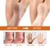Orange-Scented Foot Peeling Spray, 100 mL, 3-Pack view 3