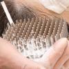 Scalp Massager Shampoo Brush with Soft Bristles view 3