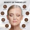 MITHCO PDO Protein Threads for Facial/Full-Body Tightening, 29G × 25 mm, 20 Count view 2