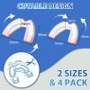 4-Piece Nighttime Teeth-Grinding Mouth Guard Set, 2 Sizes view 2