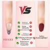 Viugex 24-Piece Press-On Nails, Medium Almond, Nude Pink with Cherry Design and French Tips view 4