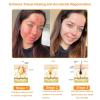 Bee Venom Cream for Face and Body, 30 mL (5-Pack) view 3
