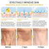 Bee Venom Cream for Face and Body, 30 mL (5-Pack) view 4