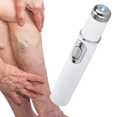 Spider Vein Removal Skin Relief Tool, Cordless Vascular Care Pen