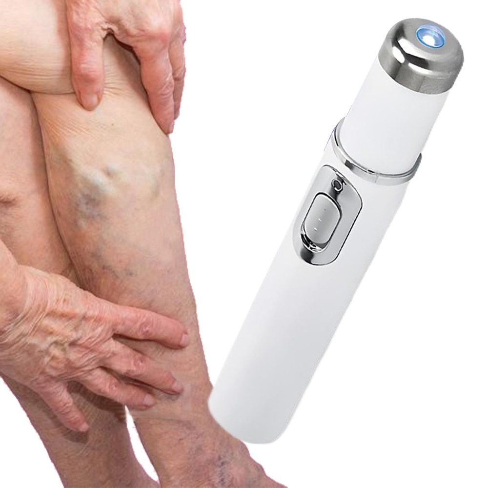 Spider Vein Removal Skin Relief Tool, Cordless Vascular Care Pen