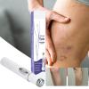 Spider Vein Removal Skin Relief Tool, Cordless Vascular Care Pen view 2