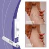 Portable, Fast-Acting, Cordless Spider Vein Removal Device view 3