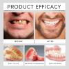 Full Dentures, Flexible Silicone Relining Set, 3 Sets view 3
