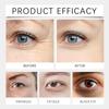 Lutein Anti-Wrinkle Eye Serum and Oil for Dark Circles, Eye Bags, and Puffiness (3-Piece Set) view 2