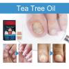 64-Count Nail Fungus Treatment Patches for Damaged Nails view 4