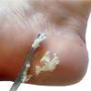 Foot Rasp Callus Remover, Portable Foot Care Tool view 4