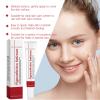 Facial Pigment Spot Remover Cream with Vitamin C, 20 g, 2-Pack view 2