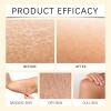 Turmeric & Vitamin C Brightening Body Lotion, 100 g view 3
