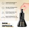 Curcumin Brightening & Wrinkle Serum, Anti-Aging & Acne Facial Serum, Essential Oil for the Face, Moisturizing for All Skin Types view 4