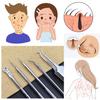 JZK 5-Piece Blackhead and Blemish Removal Tool Set view 3