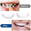 2 Pairs of Cosmetic Snap-On Veneers for Upper and Lower Teeth view 4