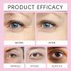 Advanced Peptides Eye Cream for Dark Circles and Puffiness, Anti-Aging Eye Repair Cream, 5 Bottles view 3