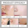 Black Rice Ampoule & White Rice Peeling Serum, Facial Exfoliator (1 Set) view 3
