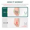 Welnove Ball-of-Foot Cushions for Women and Men, 1/8" and 1/4" Thick, Felt Metatarsal Pads, 4 Pairs view 3