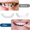 2 Pairs of Clip-In Veneers for Upper and Lower Teeth, Temporary Cosmetic Artificial Teeth view 4
