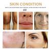 Turmeric Oil for Face and Body, Brightening Anti-Aging Serum, 3-Pack view 3