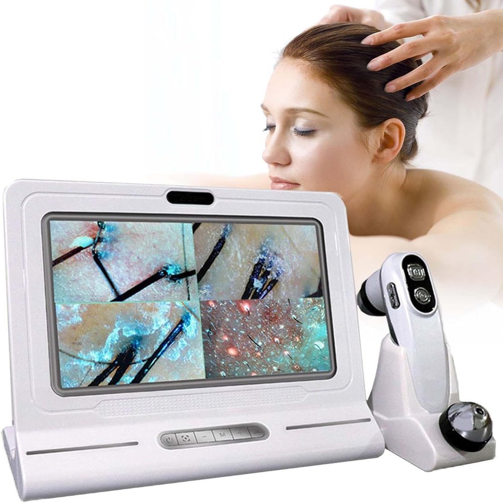 MINHUIJIHUI Hair Loss Analyzer and Skin Scanner with 11-Inch Display, 32GB Storage and 50x/200x Zoom