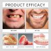 Complete Denture, Multifunctional Silicone Fitting Set, Upper and Lower Dentures, Clip-On Veneers, Easy-to-Apply Silicone Dentures view 2