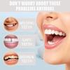 Complete Denture, Multifunctional Silicone Fitting Set, Upper and Lower Dentures, Clip-On Veneers, Easy-to-Apply Silicone Dentures view 4