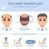 Hair Follicle Extractor for Hair Transplantation – Stepless Speed Control, 0–20,000 rpm view 2