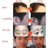 Hair Follicle Extractor for Hair Transplantation – Stepless Speed Control, 0–20,000 rpm view 3