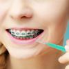 Interdental Brush, PP and Stainless Steel, Green view 3