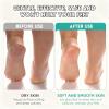 Callus Remover for Feet, Double-Sided Silicone Cleaning Brush view 4