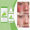 Organic Aloe Vera Gel for Face, Soothing & Nourishing, for Dry & Stressed Skin, Sunburn, After-Sun Care (3) view 2