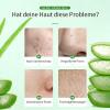 100% Pure Organic Aloe Vera Gel for Face and Body, After-Sun Care view 2