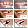 Generic Silicone Denture Reline Set, 3 Pairs view 3