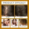 QPJUVC Hair Growth Serum with Rosemary Oil, 60 ml view 2