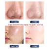 MINHUIJIHUI 10-in-1 Aqua Beauty Device, Professional Hydrogen-Oxygen Machine with 10 Attachments view 2