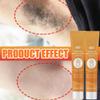 NHPY 2-Pack Facial Hair Removal Cream for Women and Men view 4