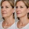 Collagen Face Sculpt Wrap, Reusable Jawline Shaper Chin Strap for Sleeping, Skin-Friendly and Breathable (Gray, S) view 4