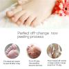 2-Pack Foot Peeling Masks for Dry, Cracked Feet view 4