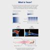 GEJLELDS Tecar Physiotherapy Device, 300 W, 448 kHz, Portable CET/RET/RF Diathermy Device for 10 Body Areas view 4