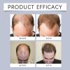 Biotin Rollerball Hair and Scalp Serum, Lightweight Non-Greasy, 18 mL, 1 Piece view 3