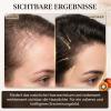 Hair Growth Spray for Men & Women – Supports Fuller-Looking Hair view 4